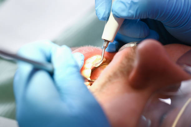 Best Emergency Treatment for Toothache in Hayesville, OR